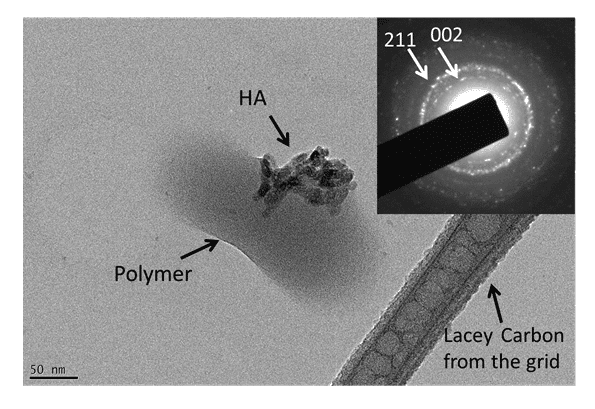 Figure 8 shows the TEM image of a nanoparticle of the hydroxyapatite