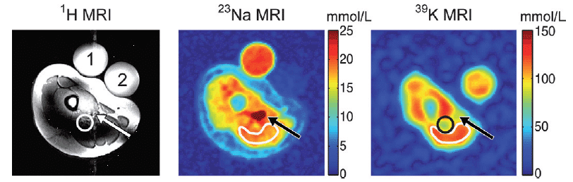 Figure 17 shows the potassium-39 MRI analysis of human muscle