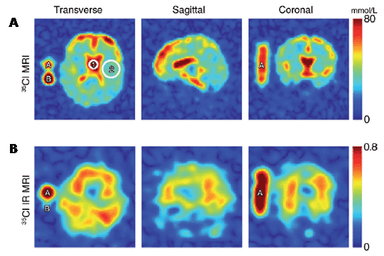 Figure 16 shows the chlorine-35 MRI analysis of human brain