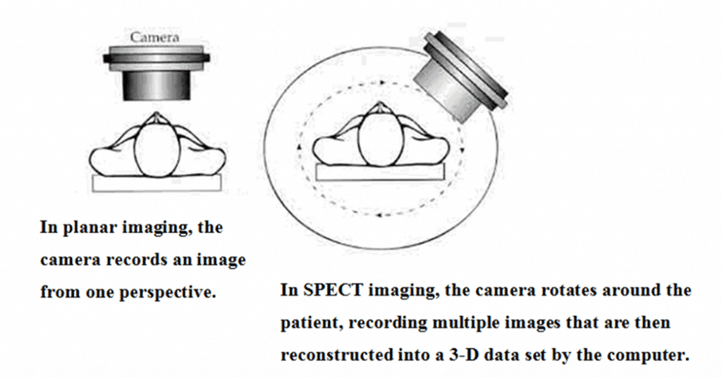 Figure 1 shows a schematic diagram of SPECT Imaging and the radiotracers
