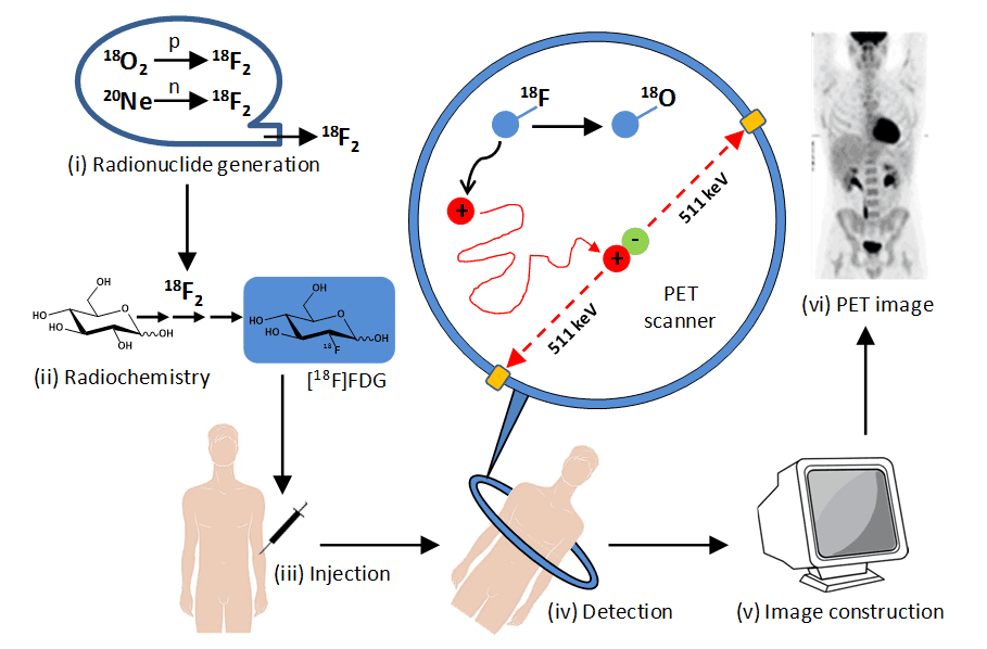 Figure 2 shows the stages in PET imaging of the human body