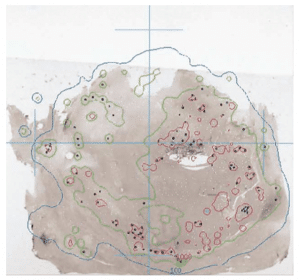 A review of 3D image-based dosimetry of 90Y microsphere therapy and dosimetry