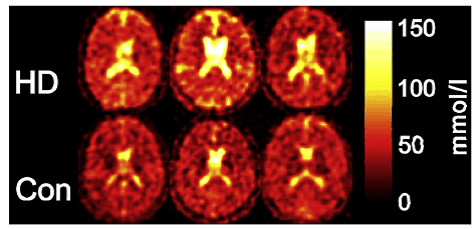Figure 13 shows the sodium-23 MRI analysis of human brain