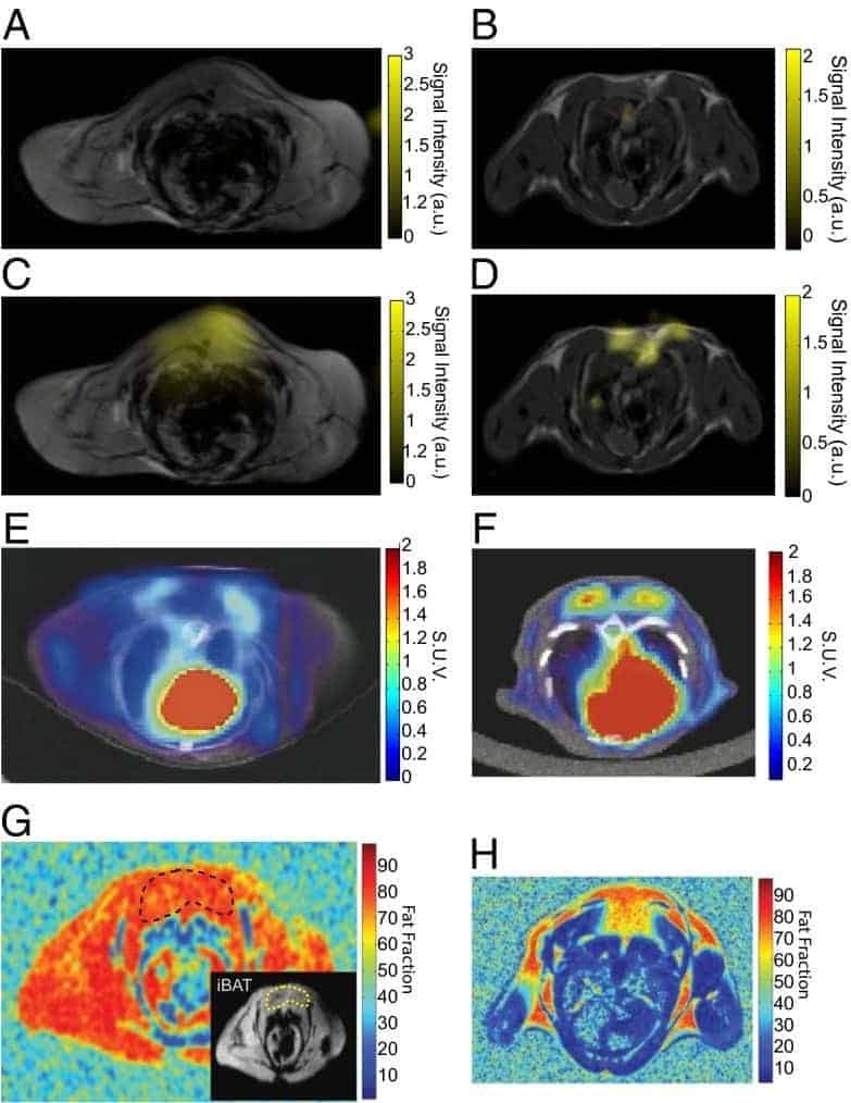 Figure 24 shows hyperpolarised xenon-129 MRI mapping of human lung using nmr active nuclei