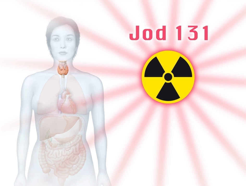 Thyroid Cancer Radioactive Iodine / Consensus Reached in