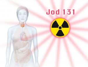 Thyroid Cancer Patients Treated with Radioactive Iodine Ablation
