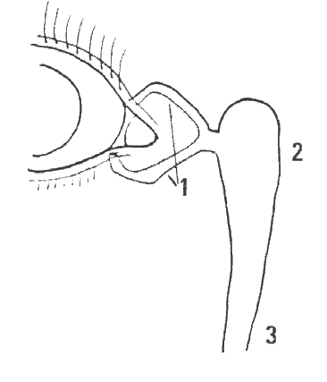 Figure 1 shows the lacrimal drainage system