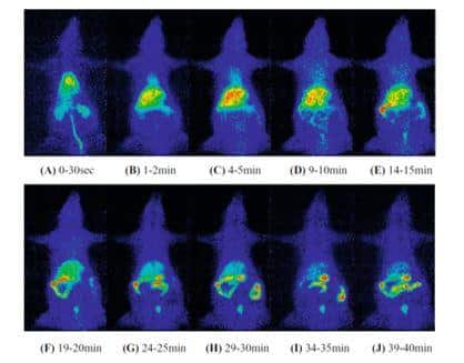 Figure 9 shows whole-body imaging of carbon-11 labelled diphenylhydantoin injected into tail vein of rat
