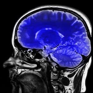 single photon emission computed tomography imaging of the brain