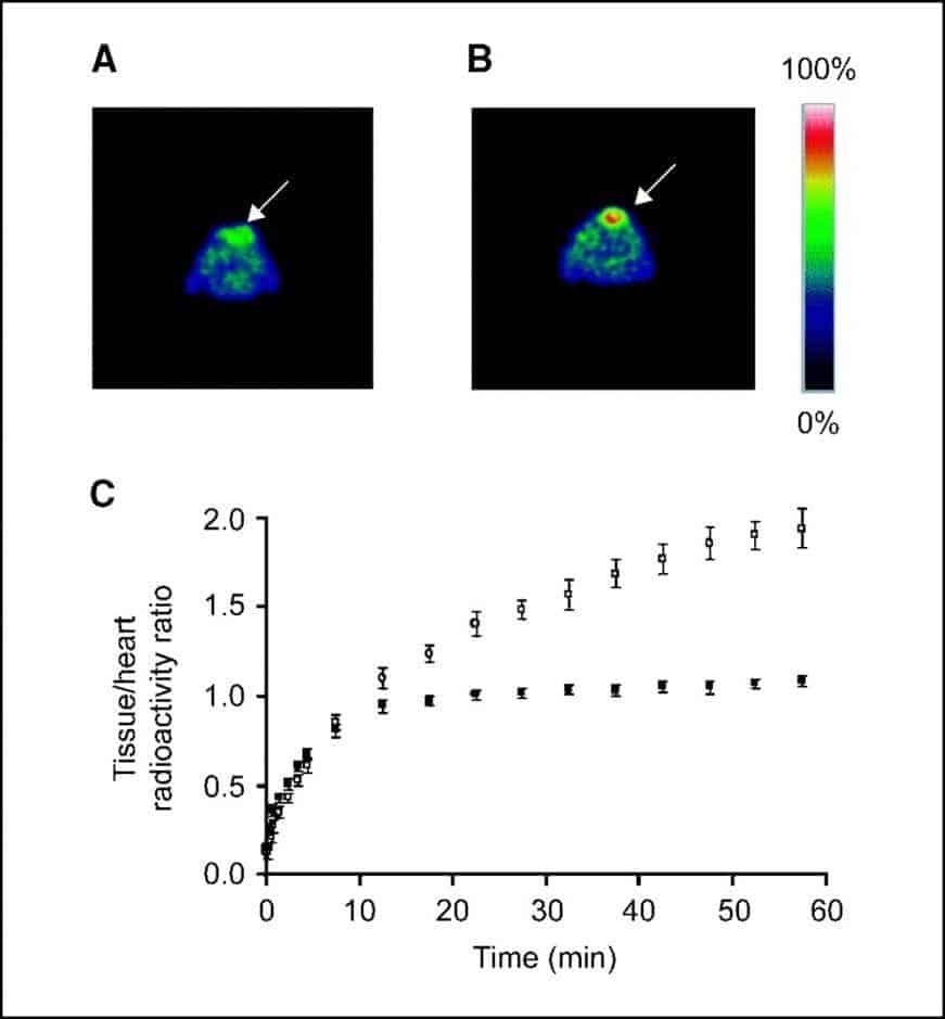 Figure 4 shows fluorine-18 FLT PET imaging of thymidylate synthase inhibition in tumours
