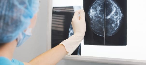Positron Emission Mammography