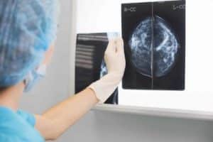 Diagnosing breast cancer using Positron Emission Mammography