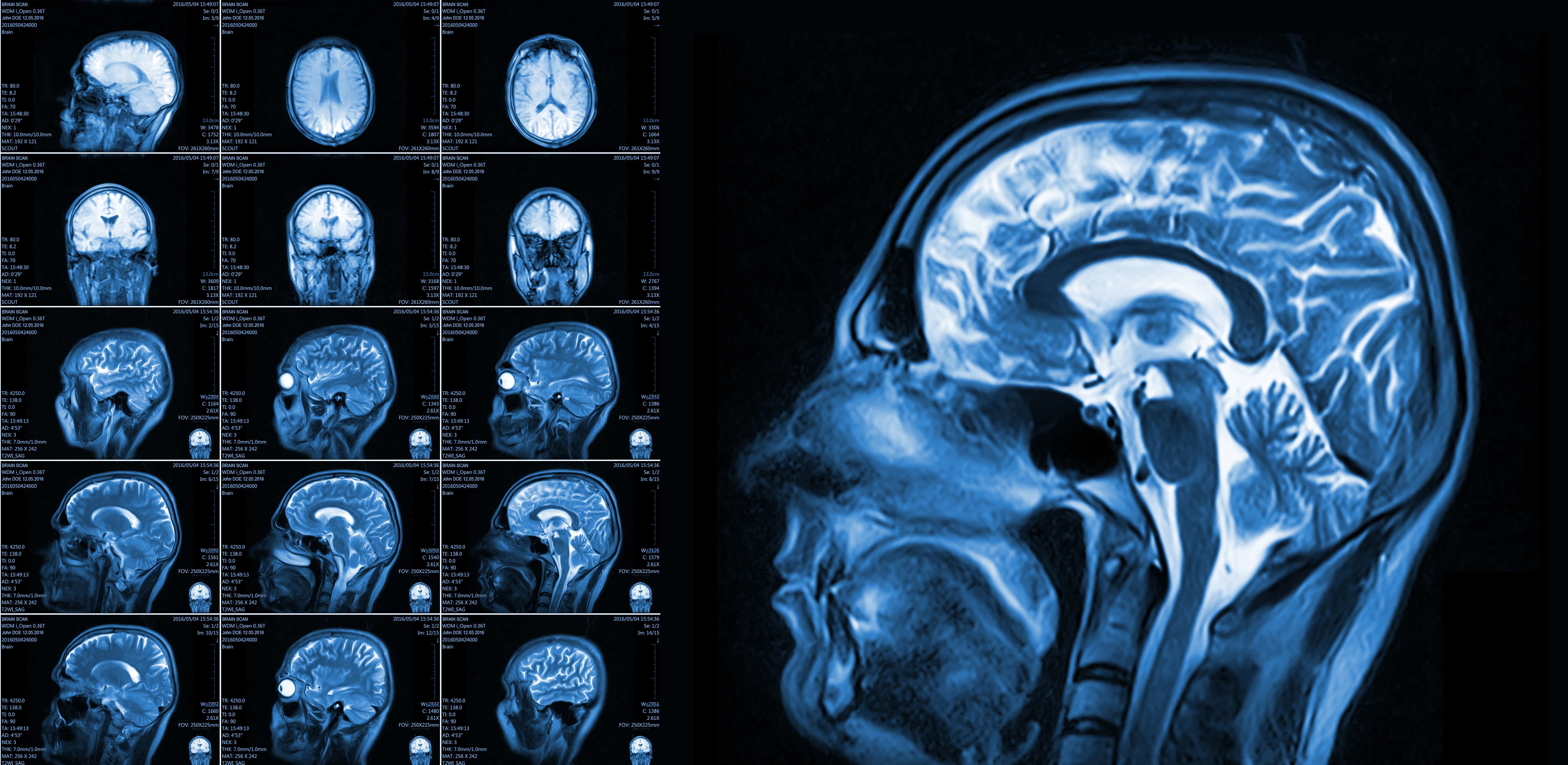 Magnetic Resonance Imaging Mri Open Medscience 