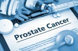 treatment of prostate cancer using Brachytherapy