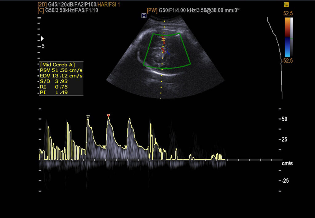 Ultrasound imaging uses sound waves to visualize internal body structures