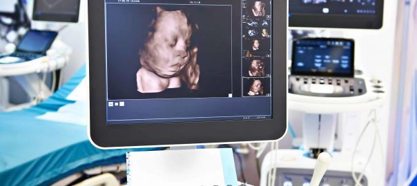 Medical Ultrasound Imaging Technology | Open Medscience