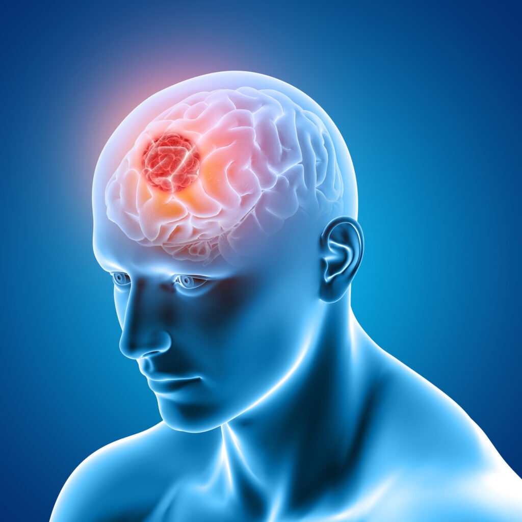 Proton beam therapy joins UK radiotherapy revolution to fight cancer