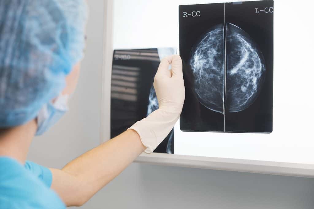 Doctor reviewing mammogram for breast cancer