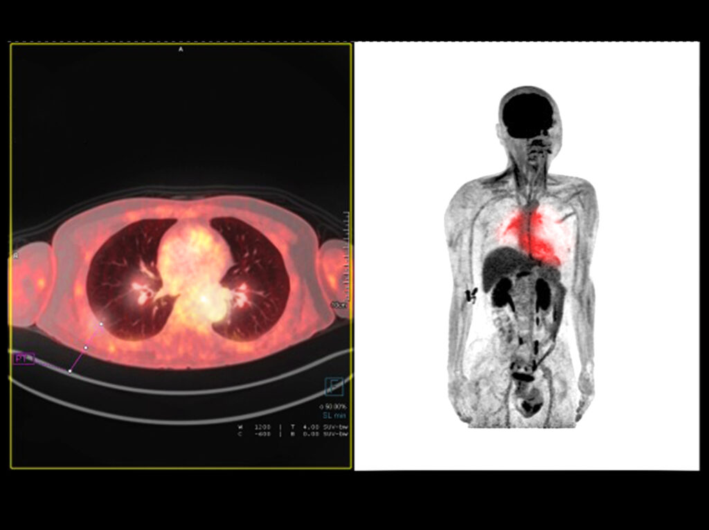 PET imaging in humans maps metabolism, aiding diagnosis and treatment planning