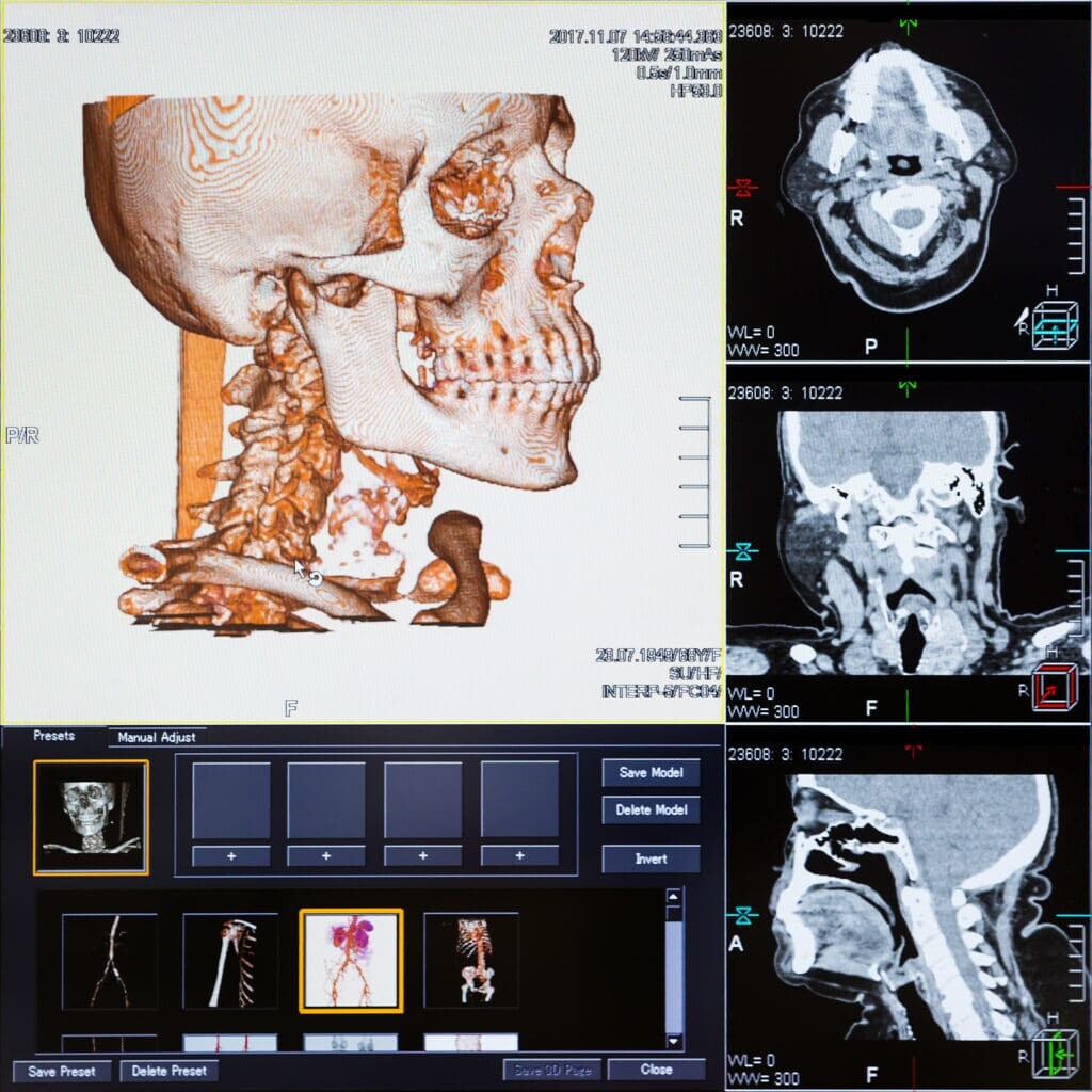 CT scanner creates 3D internal images using X-rays and computers, aiding in detailed medical diagnoses.