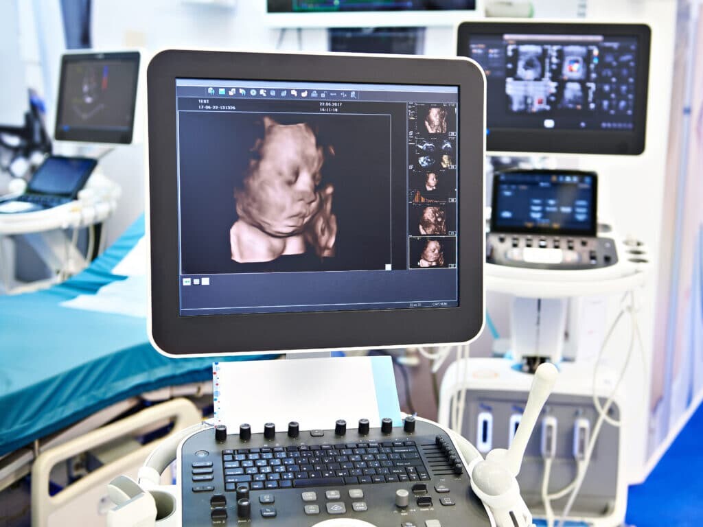 Ultrasound scanners use high-frequency sound waves to create real-time images of internal organs in the human body.