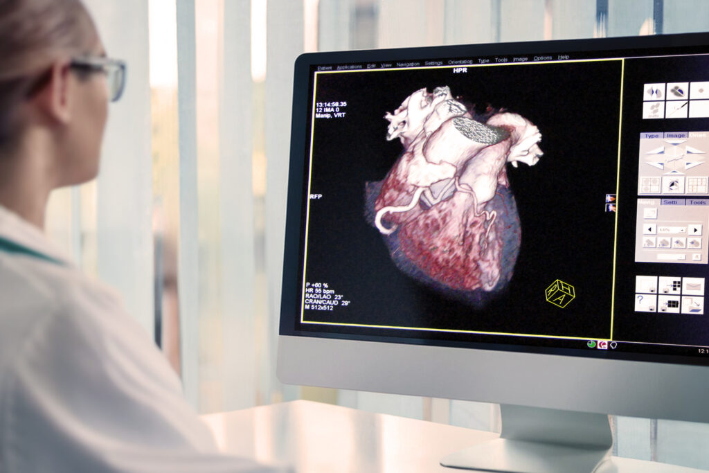Fractional Flow Reserve-Computed Tomography assesses coronary artery disease non-invasively