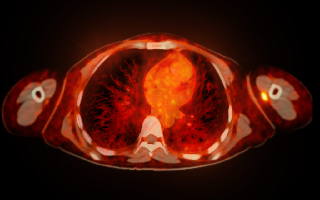 Bone imaging helps detect fractures, infections, and monitor bone disease progression