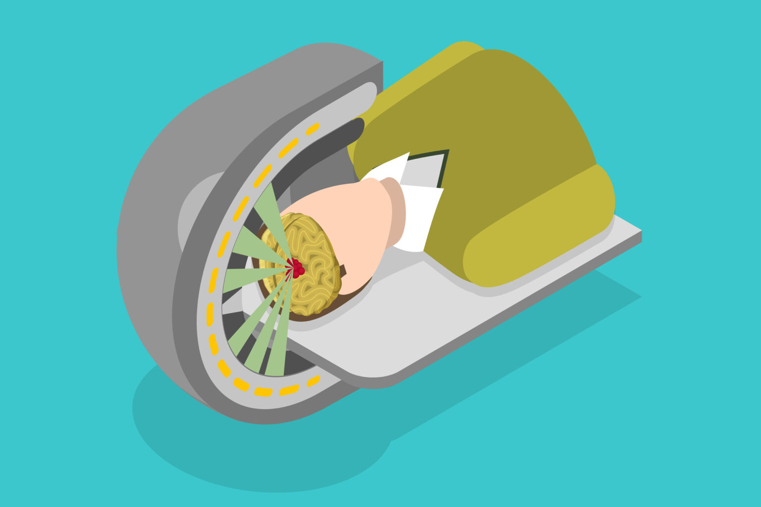 Proton therapy precisely targets tumours, sparing healthy tissue from radiation damage