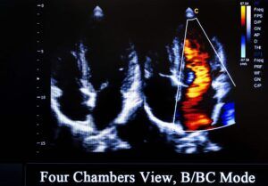 Heart imaging refers to various types of medical imaging used to visualise the structure and function of the heart