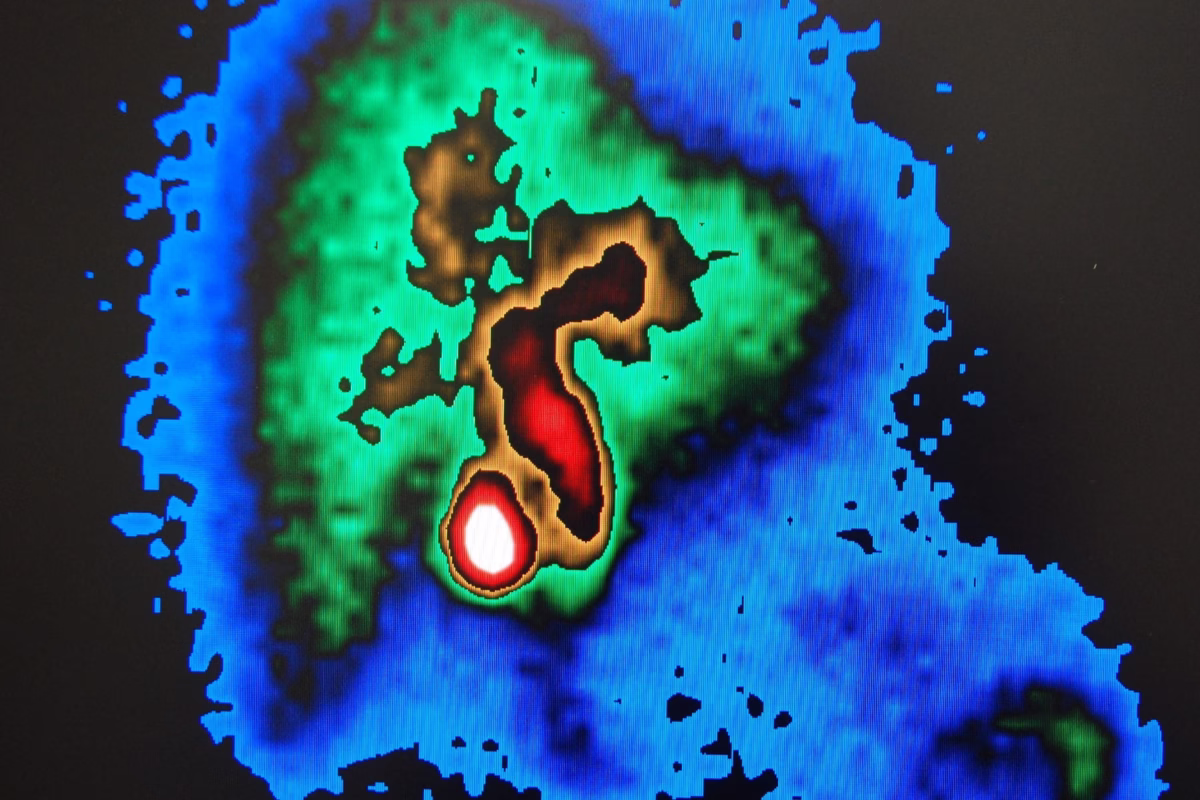 Medical imaging detects liver diseases, assesses function, and guides effective treatment plans