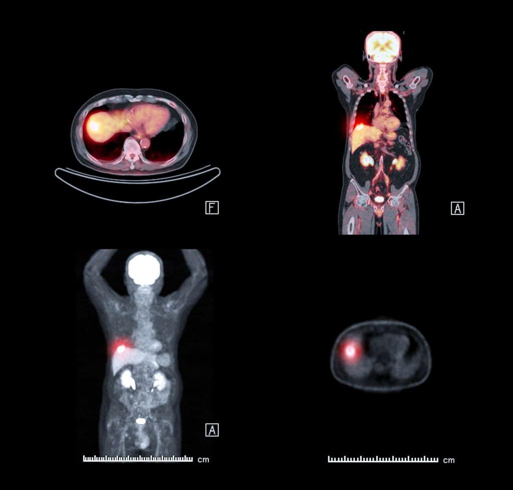 The history of nuclear medicine traces advancements in imaging, diagnostics, and treatment