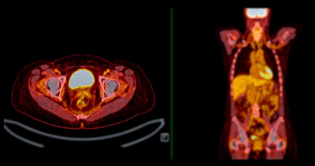 PET imaging enhances diagnostics, guides treatment, improves accuracy, and advances medical research