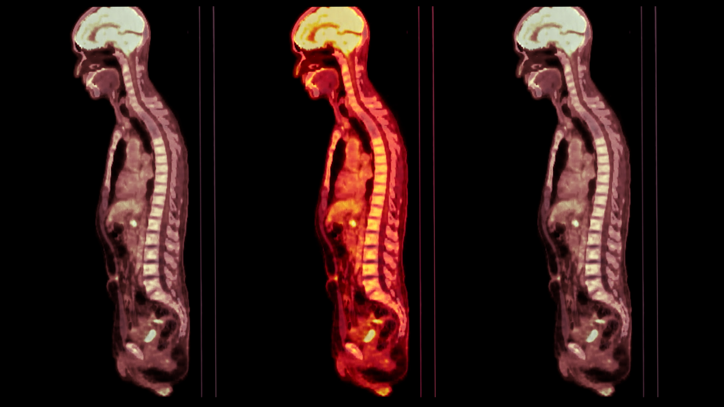 Positron Emission Tomography revolutionizes diagnostics through advanced functional imaging technology