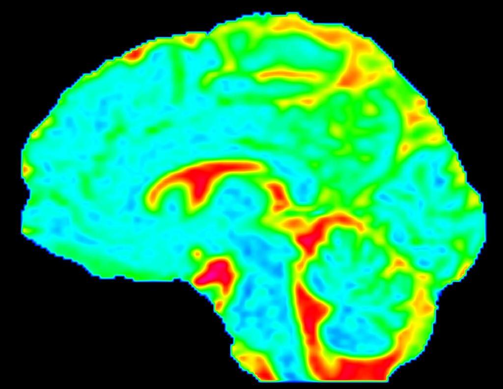 Medical imaging enhances neurological diagnostics by detecting brain disorders with precision