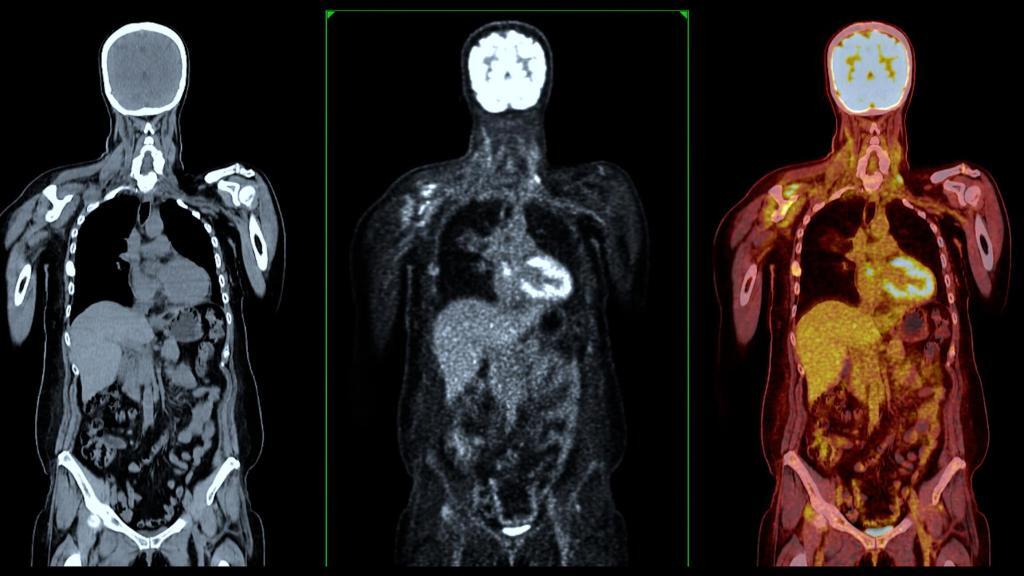 Radiopharmaceutical diagnostics enable precise imaging, disease detection, and targeted treatment planning