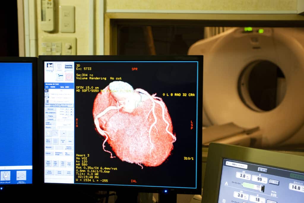 Angiography visualises heart vessels to diagnose and guide treatments.