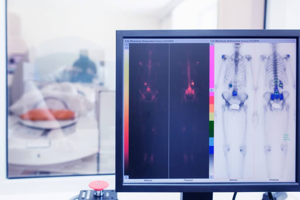 Medical radiology uses X-ray, ultrasound, and CT for diagnosis and treatment, enhancing patient care.