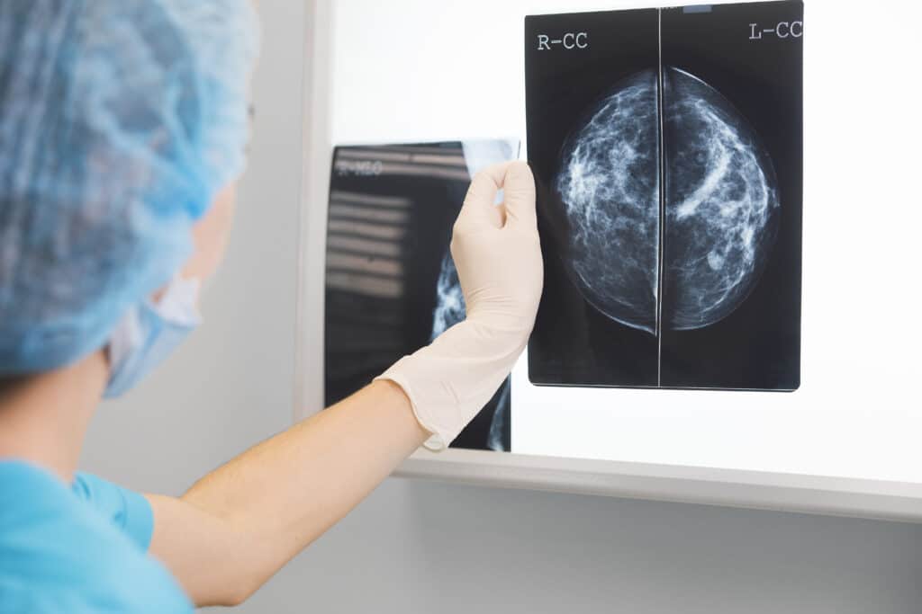 Mammography uses low-dose X-rays for breast cancer detection.