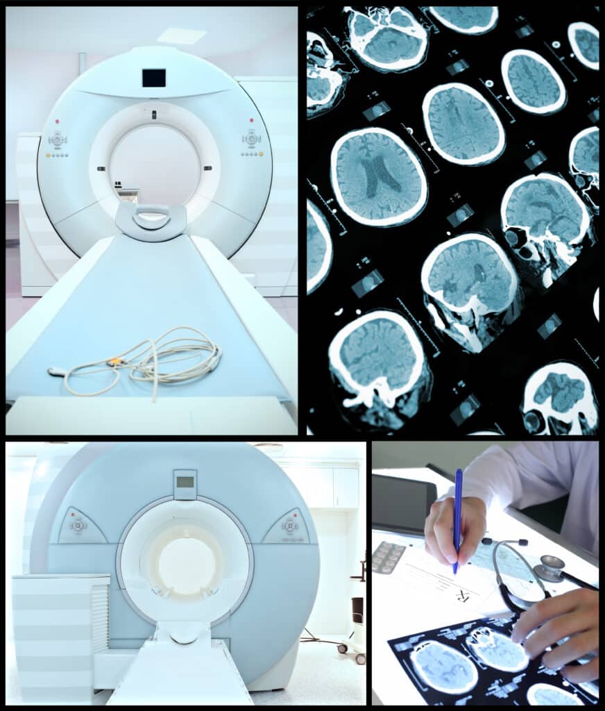 Computed Tomography (CT) scans have revolutionised medical imaging, enabling detailed, non-invasive internal body examinations.