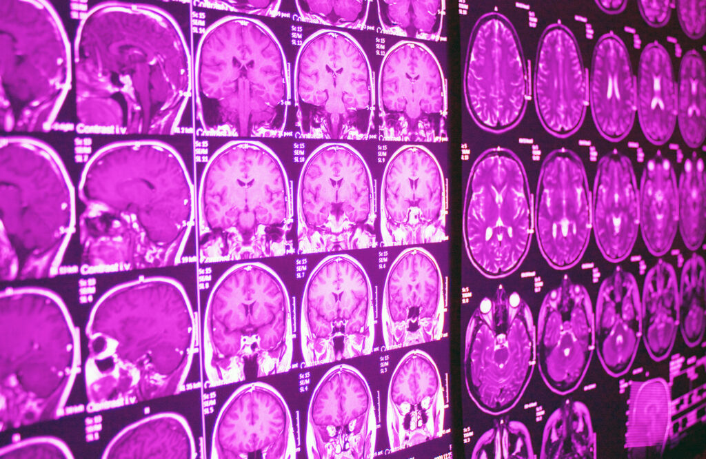 Magnetic Resonance Imaging provides detailed internal images for accurate diagnosis