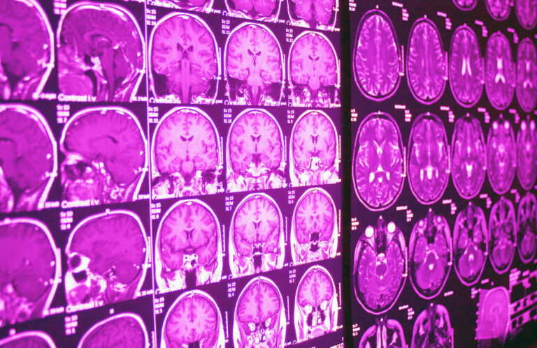 Magnetic Resonance Imaging provides detailed internal images for accurate diagnosis