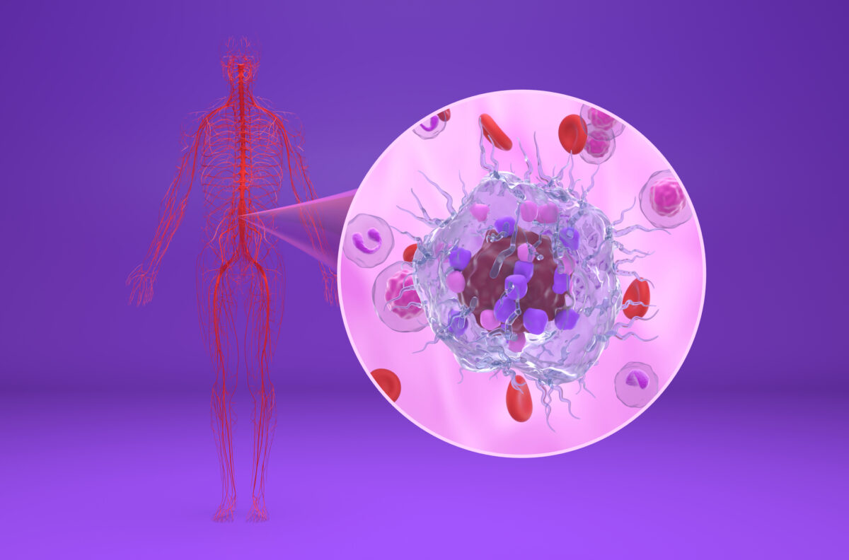 Peptide receptor radionuclide therapy effectively treats advanced neuroendocrine tumours worldwide