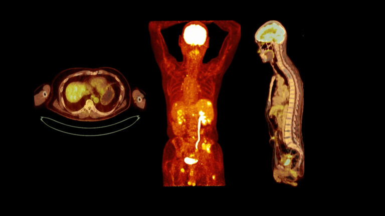 Different radiopharmaceutical types include PET, SPECT, gamma, and tracer agents