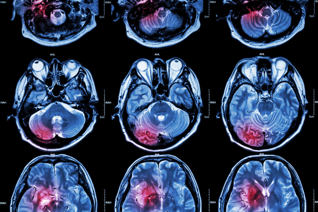 Gene therapy leads modern medicine, offering hope for inherited disease treatment