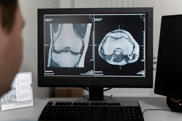 MRI technology revolutionized medical imaging, enhancing diagnostics and patient care.