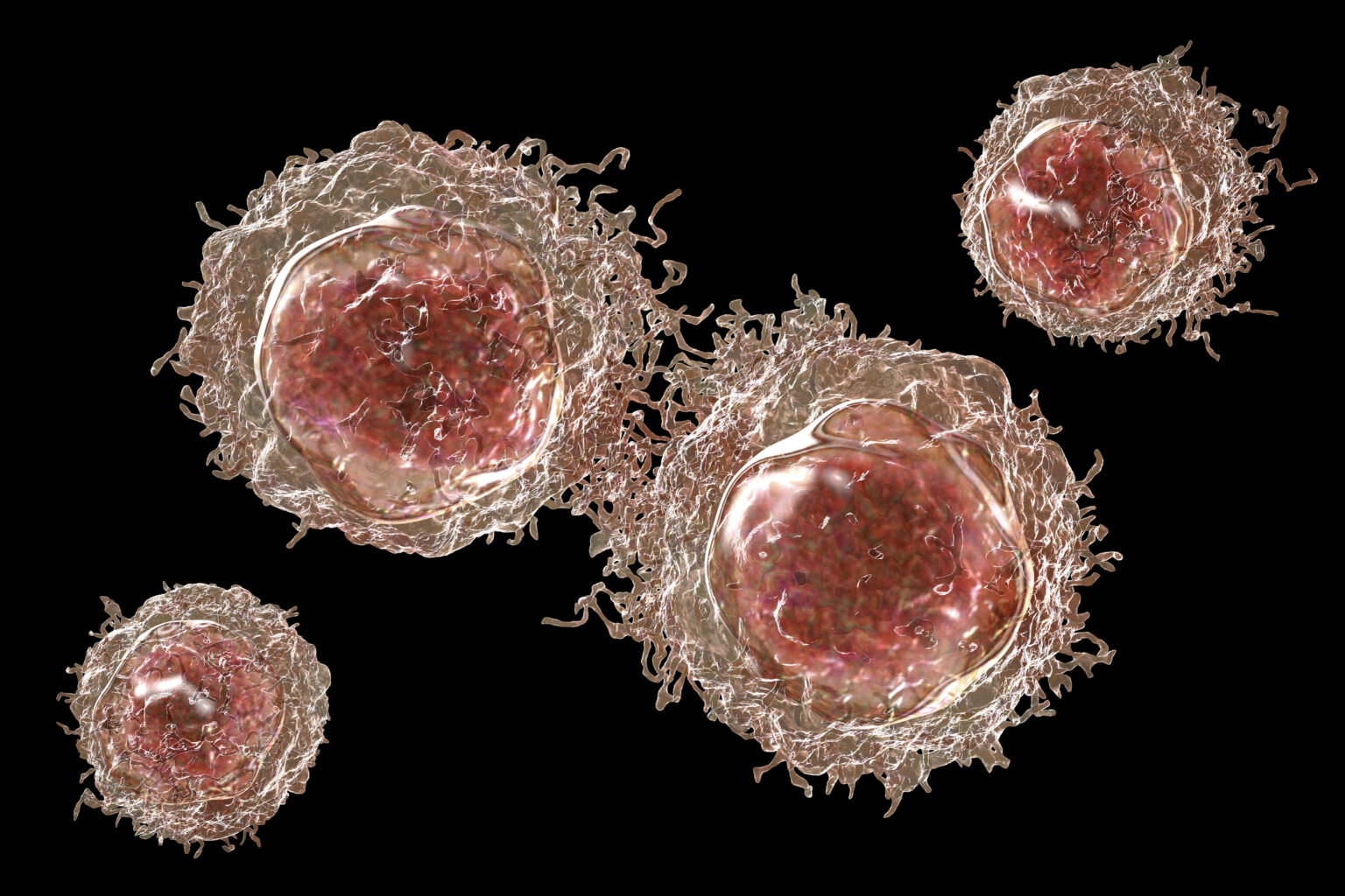 Blastomas are uncommon cancers arising from early embryonic precursor cells