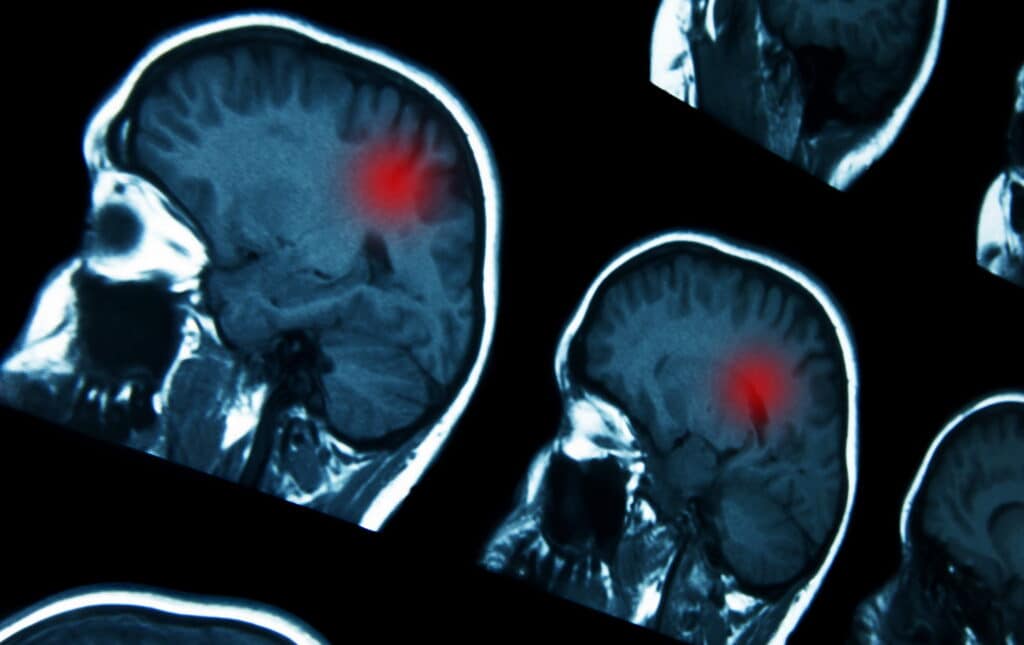 Unconjugated radionuclides are used in nuclear medicine for imaging and therapy.