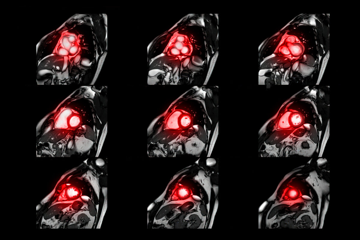 Red blood cell moves through the heart’s chambers