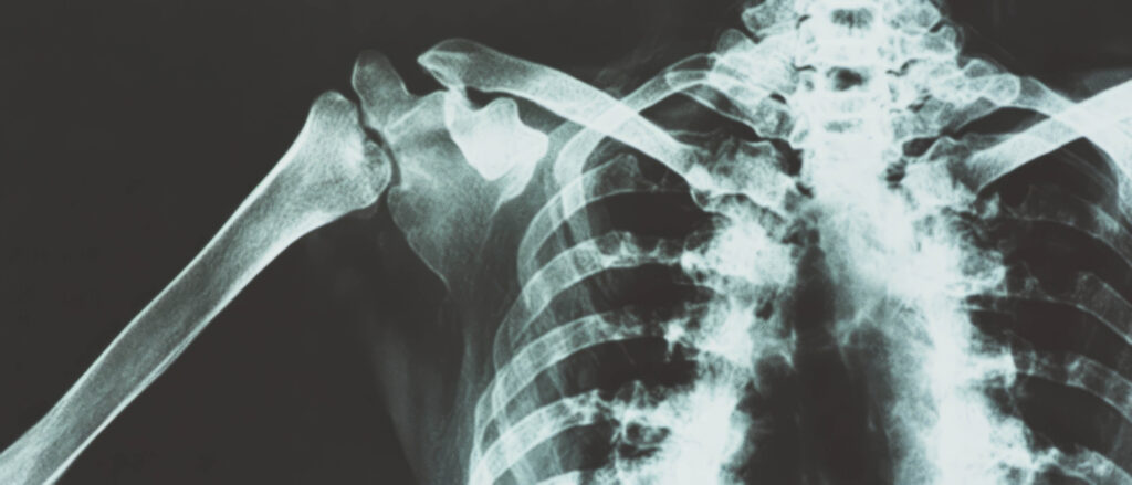 Learn to read X-ray images by identifying bones and abnormalities