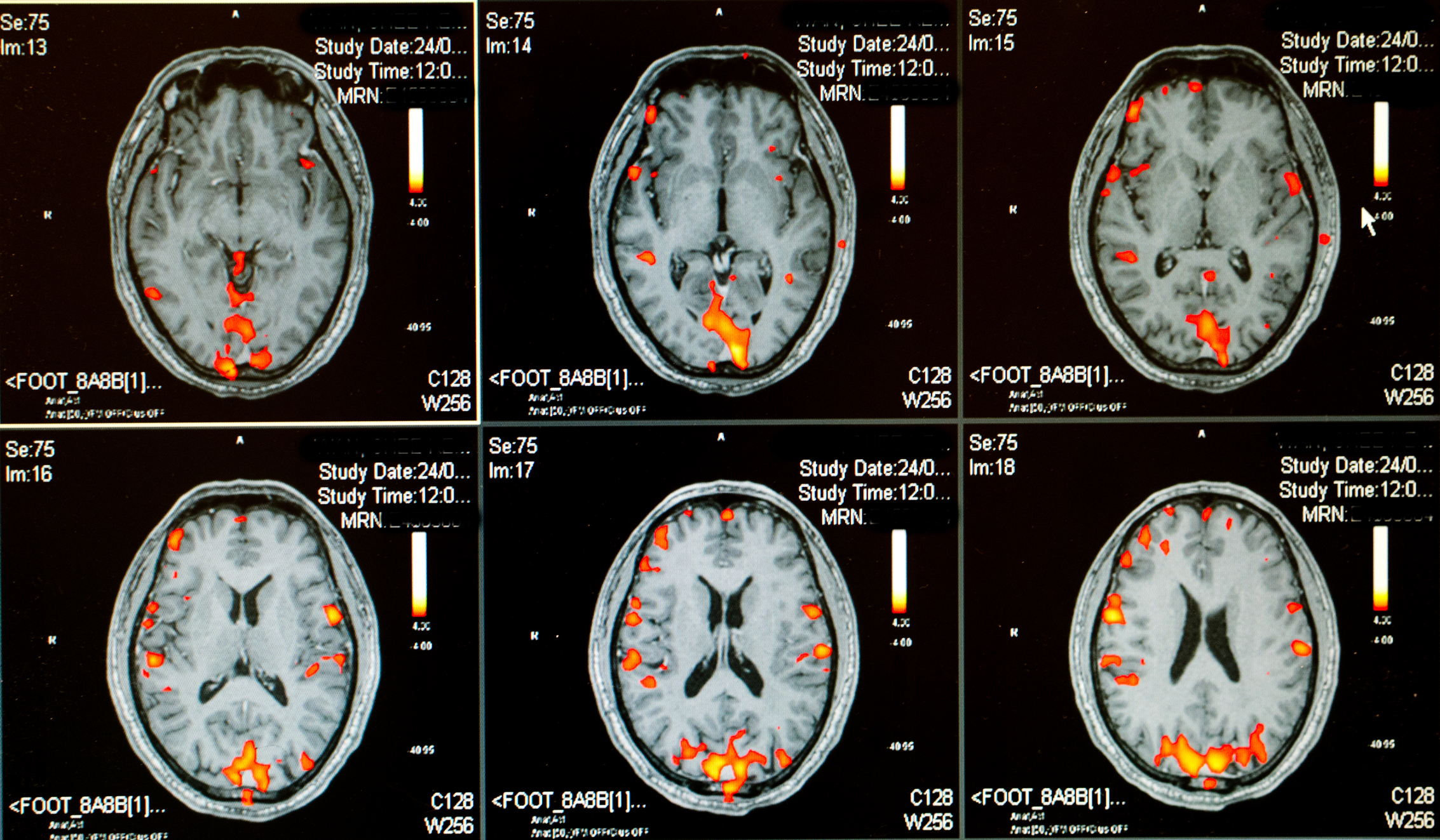 Advanced healthcare tools transform diagnosis and treatment in neurology today
